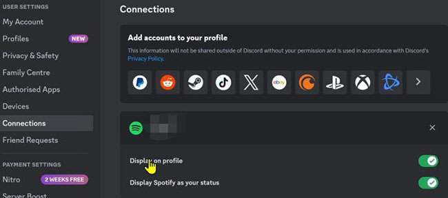spotify and discord connection